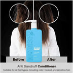 Unisex Protein Anti Dandruff Conditioner (350 ML)