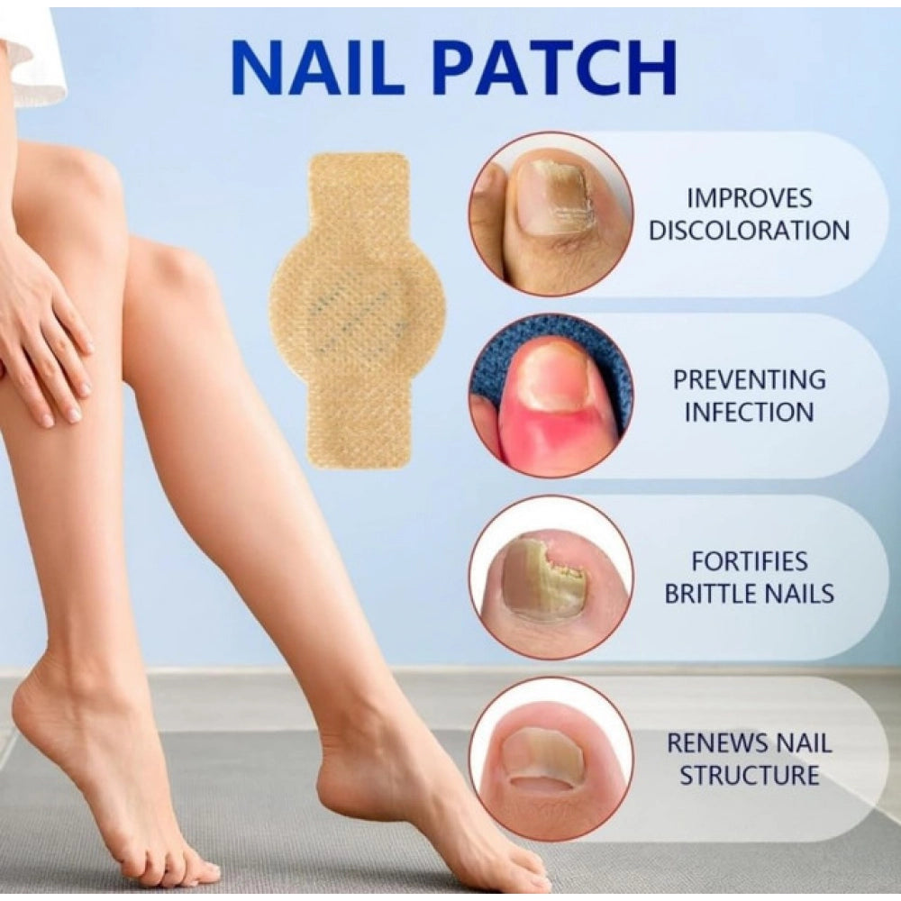 Fungal Nail Patches (Yellow)