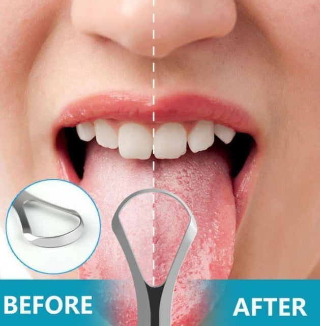 Generic Pack of 2 Stainless Steel Tongue Scraper (Silver)