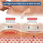 Silicone Scar Tape (Beige)