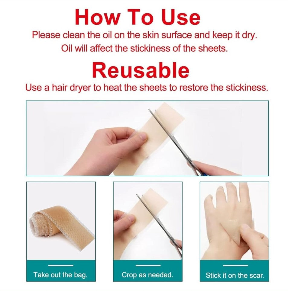 Generic Silicone Scar Tape (Beige)